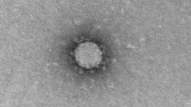 Первые снимки коронавируса под микроскопом сделали в «Векторе»