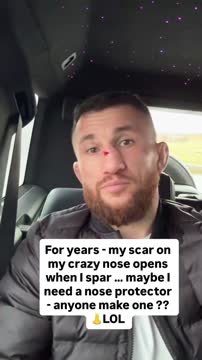 Двалишвили показал травму носа после спарринга