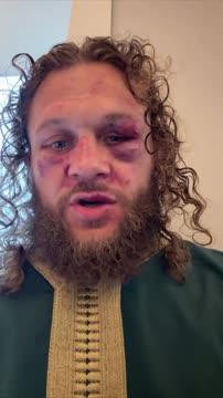 Физиев прокомментировал поражением нокаутом на UFC 325